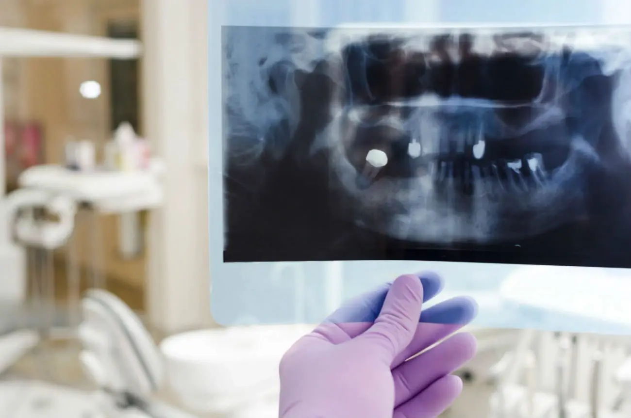 A person holding up an x-ray of something
